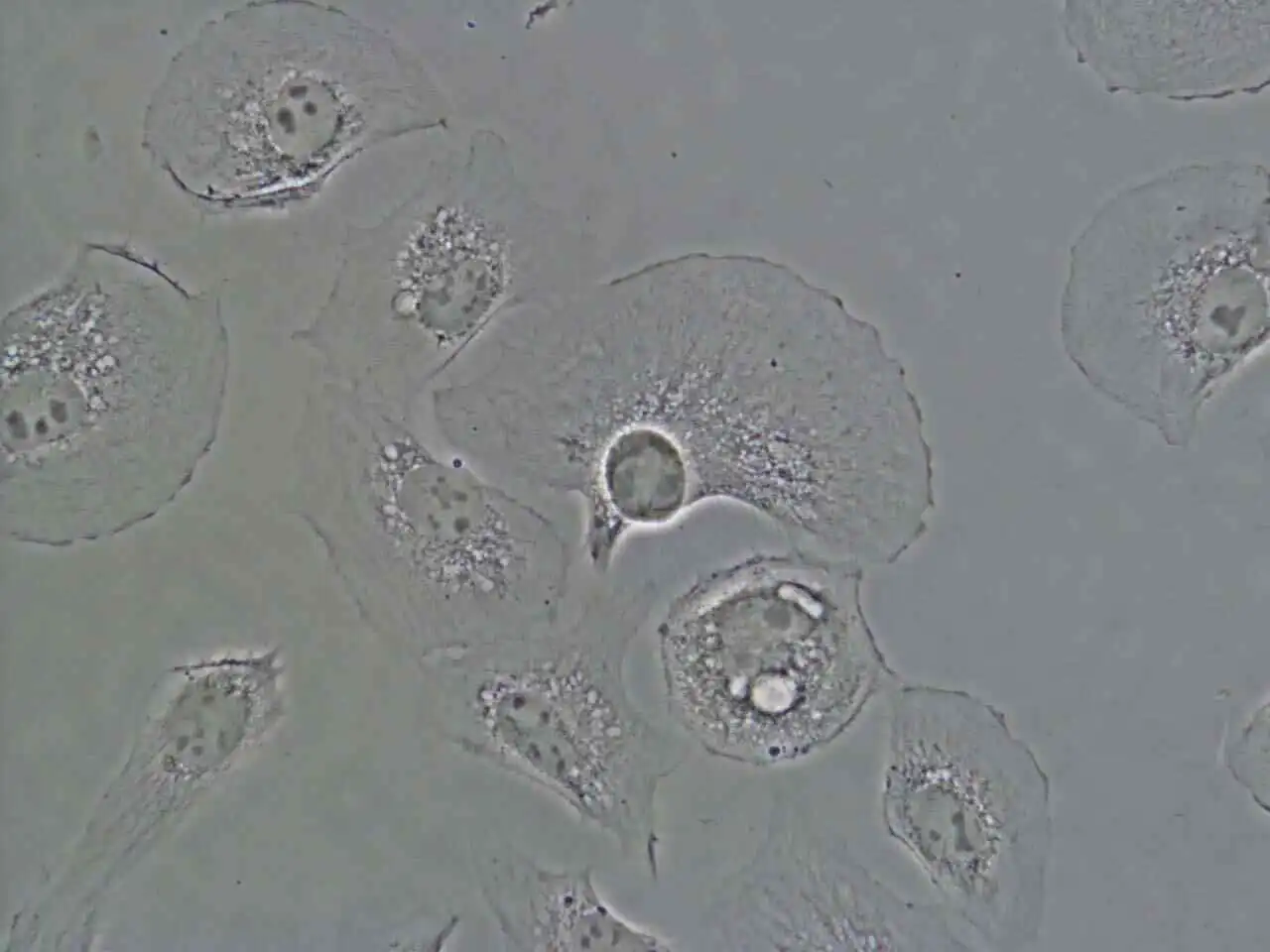 CFI S Plan Fluor ELWD ADM 40X