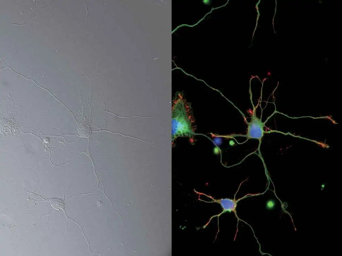 Rhodamine-Phalloidin
