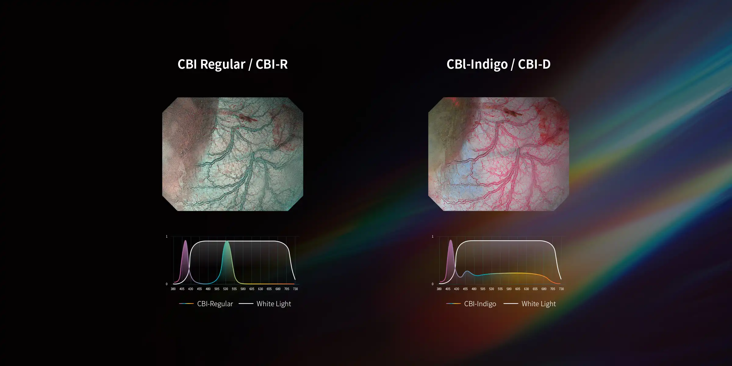 CBI Chromoendoscopy Modes