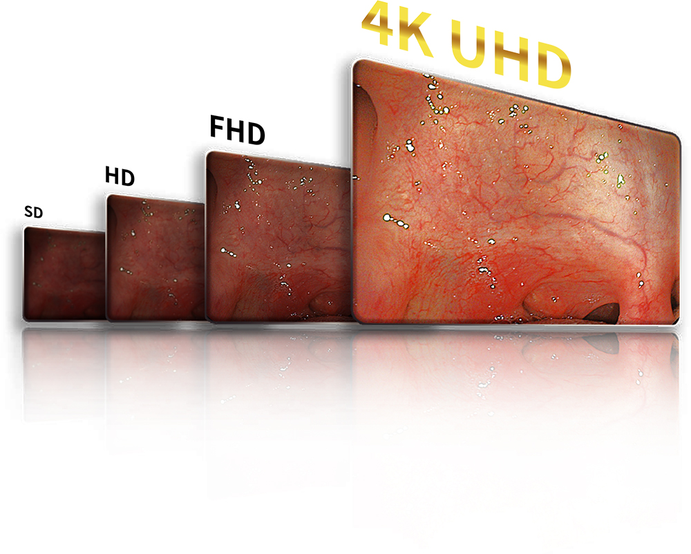 4K