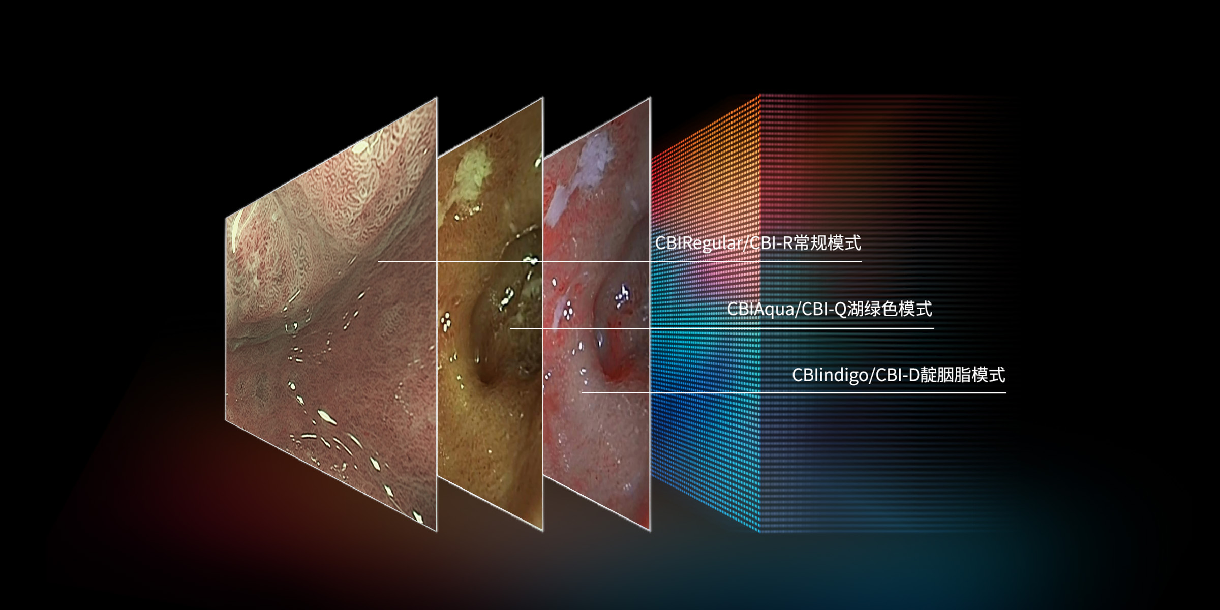 CBI 染色