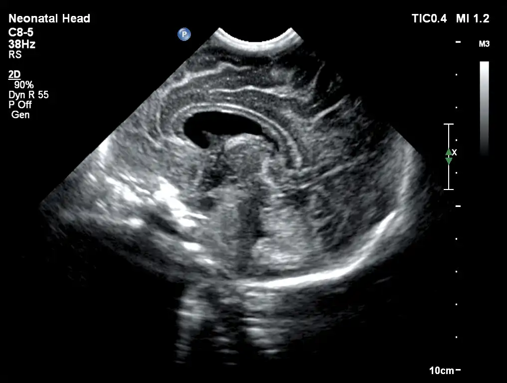 Affiniti_30_6.jpeg Affiniti_30_6.jpeg