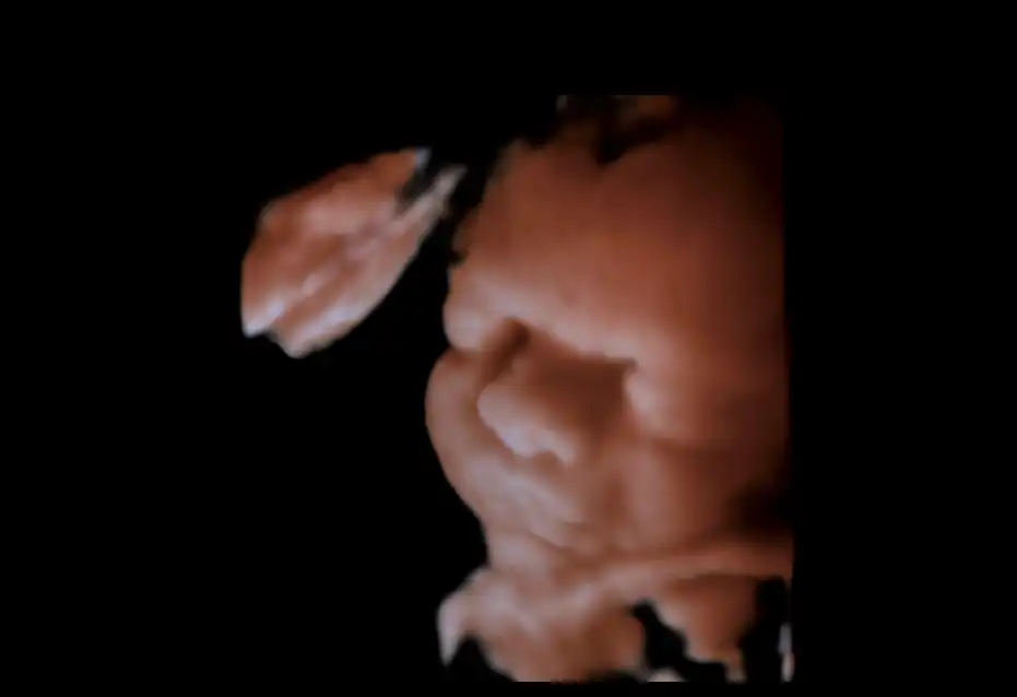 胎儿面部 胎儿面部