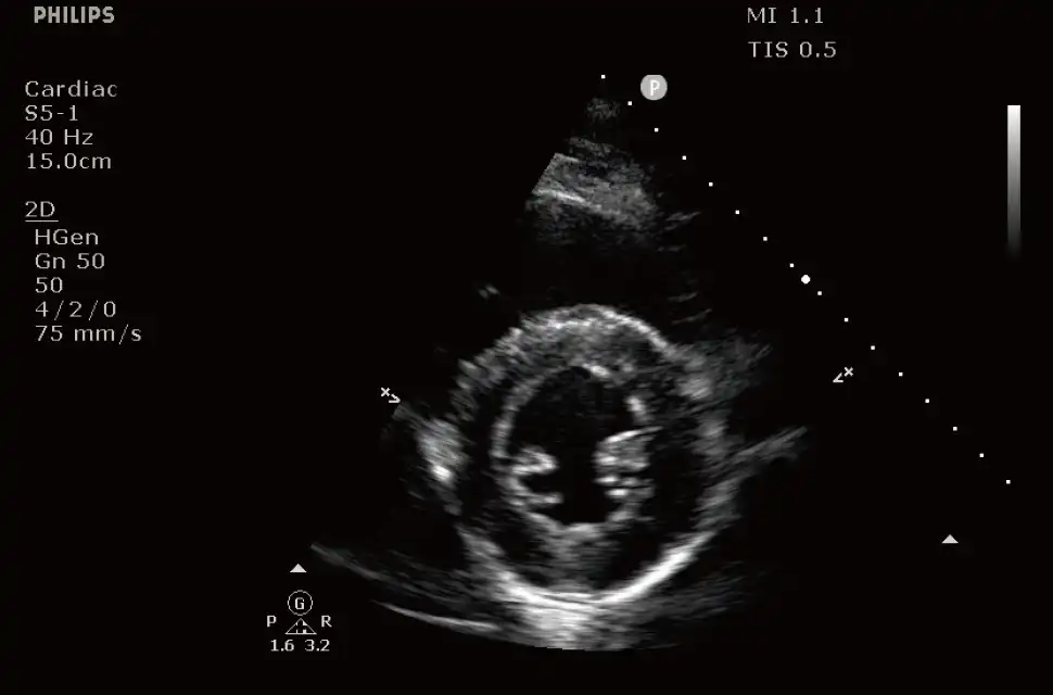 Affiniti_50_2.jpeg Affiniti_50