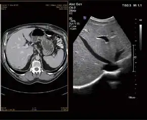 联合影像 联合影像