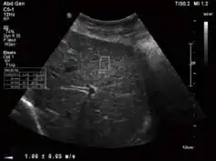 Affiniti 70 Affiniti 70