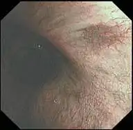 BF-1TQ290 窄带成像