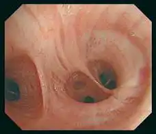 BF-H290高清图像 BF-H290高清图像