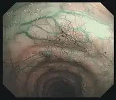 BF-H290窄带成像 BF-H290窄带成像