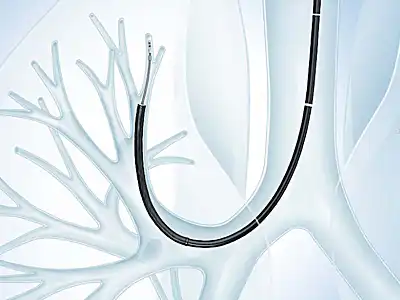 Easier approach to upper lobe bronchi Easier approach to upper lobe bronchi