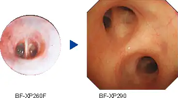 Extremely-slim-design videoscope