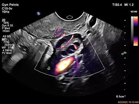 C10-3v Ovary MFI Flow Viewer
