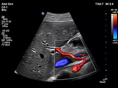 C5-1 Abdomen, with Flow Viewer