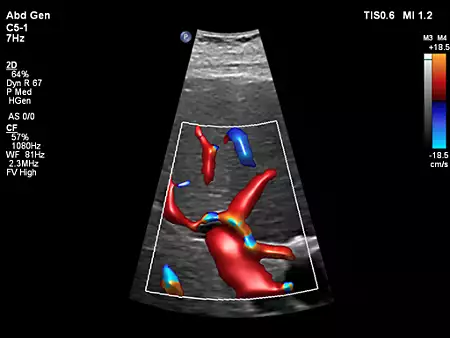 C5-1 Liver Perfusion with Flow Viewer