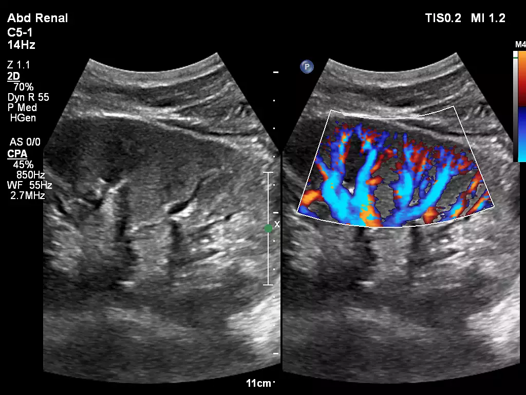 C5-1 Renal Kidney Imaging