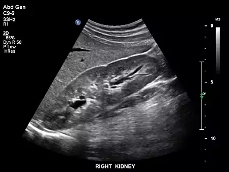 C9-2 Abdomen Renal