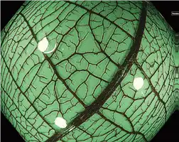 NBI近焦 NBI Near Focus