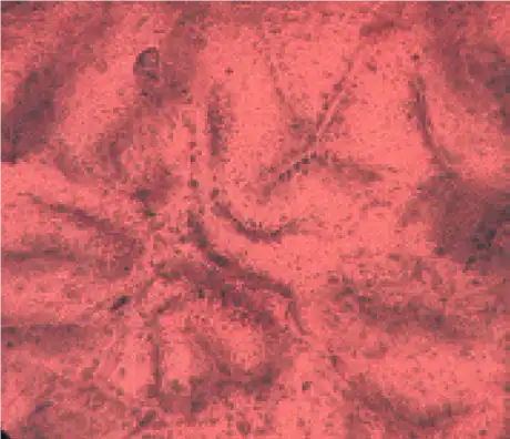 非肿瘤(食道) 非肿瘤(食道)