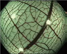 NBI 近焦 NBI 近焦