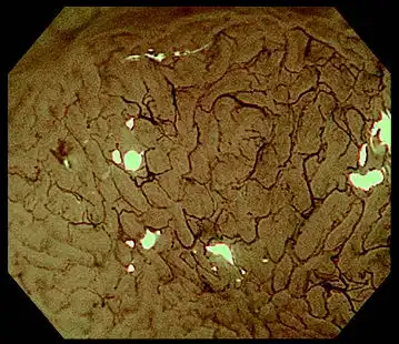 使用NBI进行光学80x放大