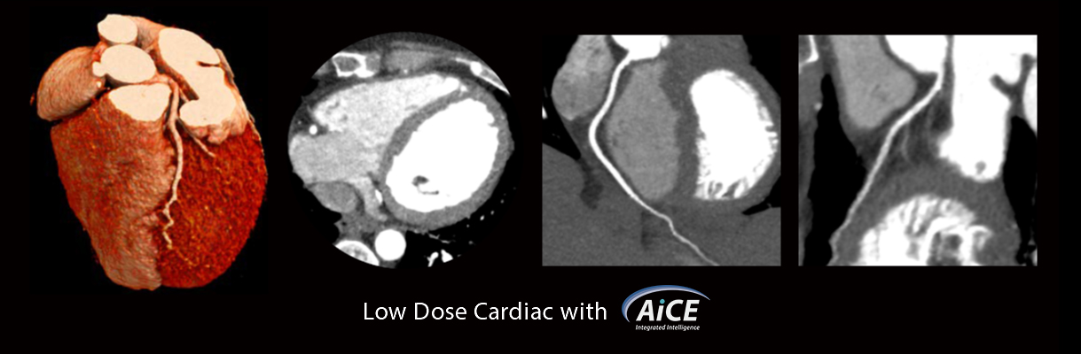 ⁠Cardiac CT