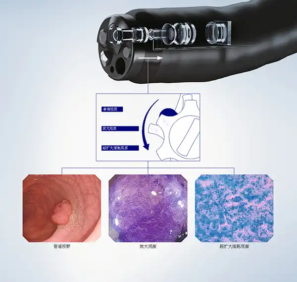 变焦杆操作以更改放大倍数 变焦杆操作以更改放大倍数