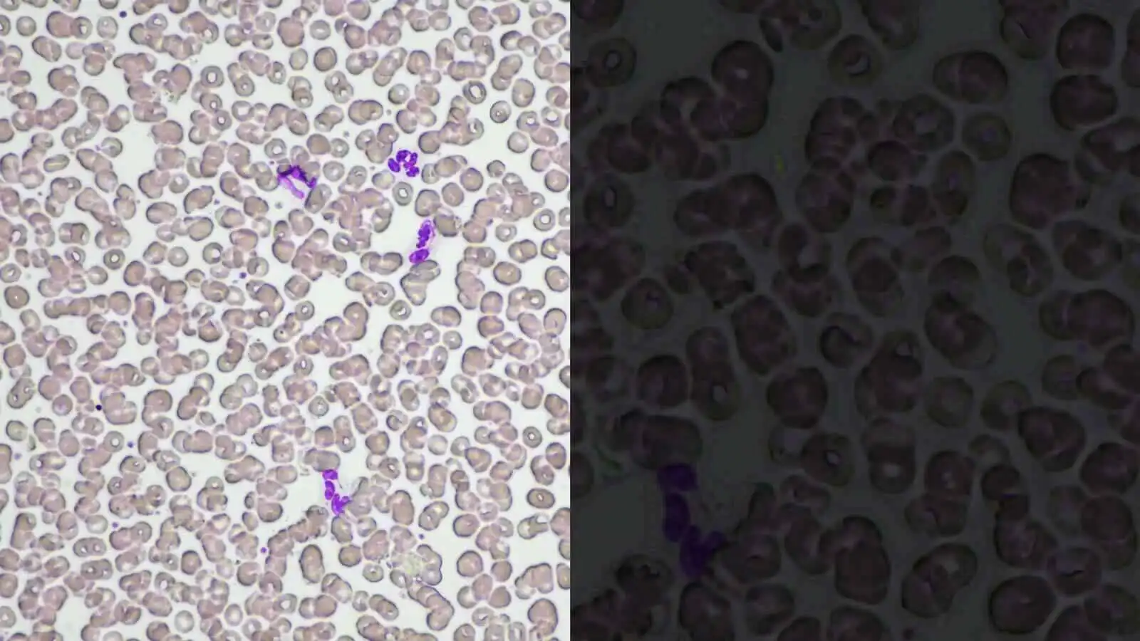 光强度管理 (LIM) 功能