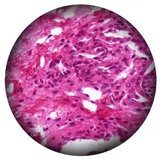 Critical Illumination