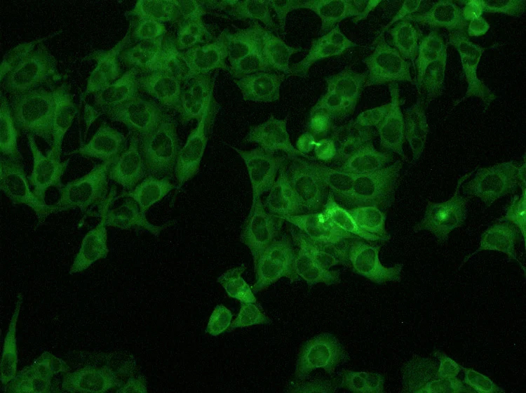 HeLa 细胞，20 倍荧光成像