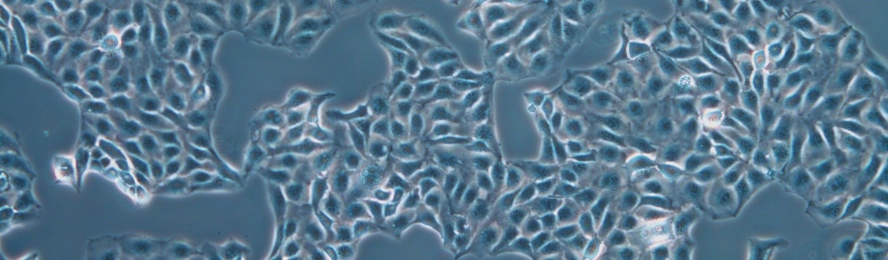 Cell Culture /></p>
<p> </p>
<h2>Just Right For Your Live Cell Lab – Smart Choice For Quick Checks</h2>
<p>The microscope’s flexibility in accommodating an S40 condenser (40 – 50 mm working distance) or switching to an S80 condenser (80 mm working distance) is achieved by just a few hand moves. High-quality Leica objectives provide brilliant images.</p>
<p>The well-thought-out design and quality control elements enable you to work in comfort, even during long routines.</p>
<p>Smart features make your workflow smooth and efficient, saving time and resources. High-quality imaging technology from Leica Microsystems provides precise results and reduces the risk of errors.</p>
<p>The microscope’s LED illumination means low energy costs and minimal downtime. No need to replace lamps often, or wait for the right color temperature to develop.</p>
<p>The DMi1 is the smart choice for excellent quality.</p>
<p><img alt= Cell Culture