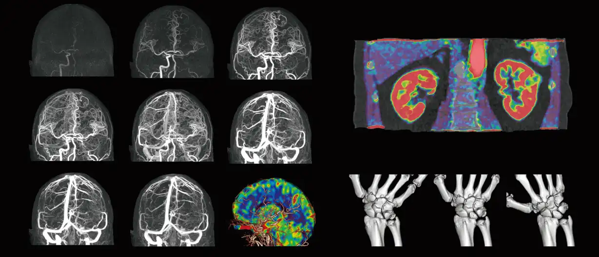 Dynamic_Functional_Imaging
