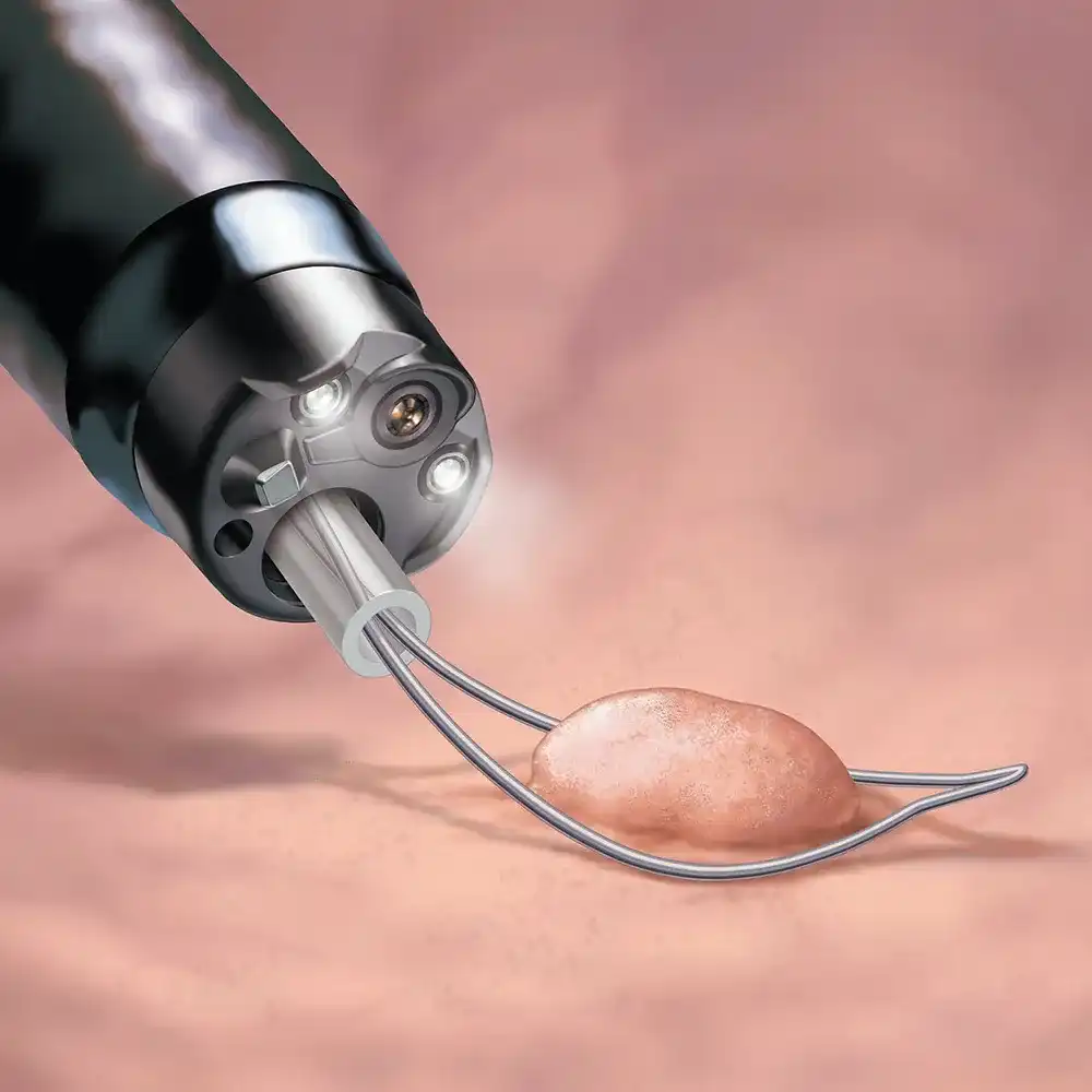 large 3.8 mm working channel