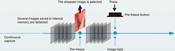 Pre-freeze
