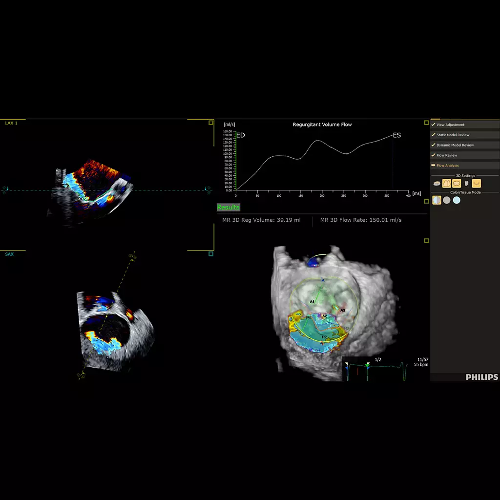 3D Auto Color Flow Quantification