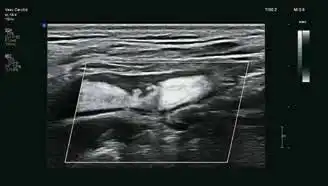 eL18-4 MFI eL18-4 MFI