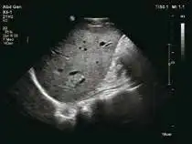 大角度明晰二维 大角度明晰二维