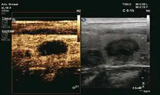 EPIQ Elite EPIQ Elite