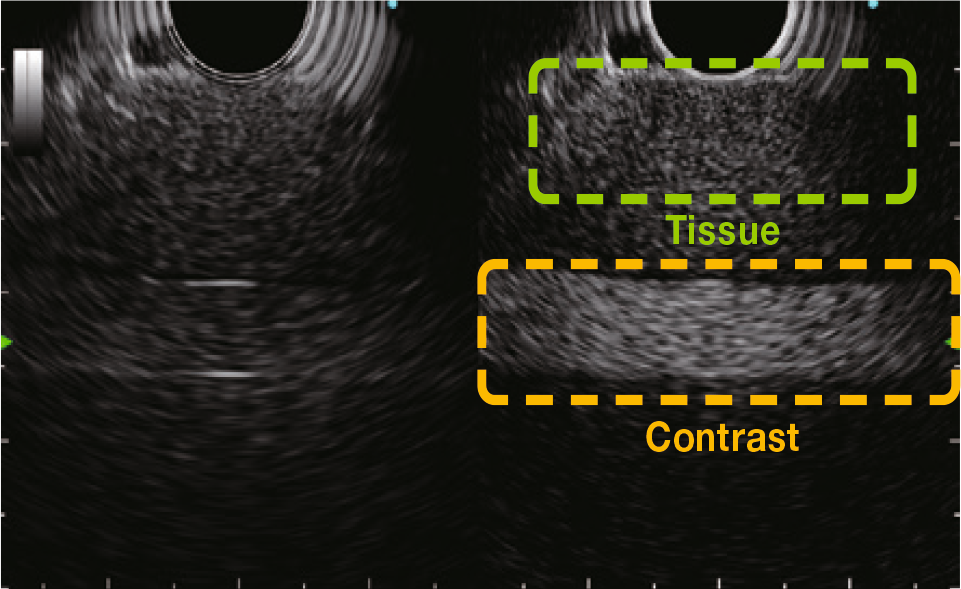 Contrast Harmonic Echo (CHE)
