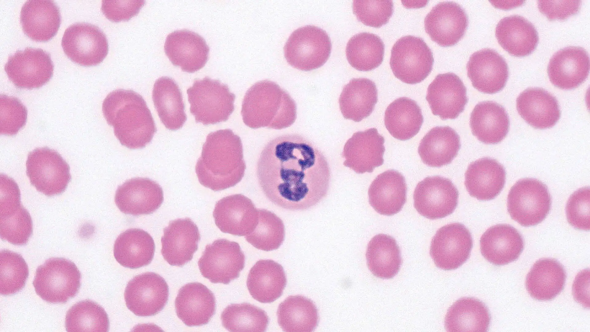 100X oil immersion objective