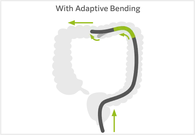 With Adaptive Bending