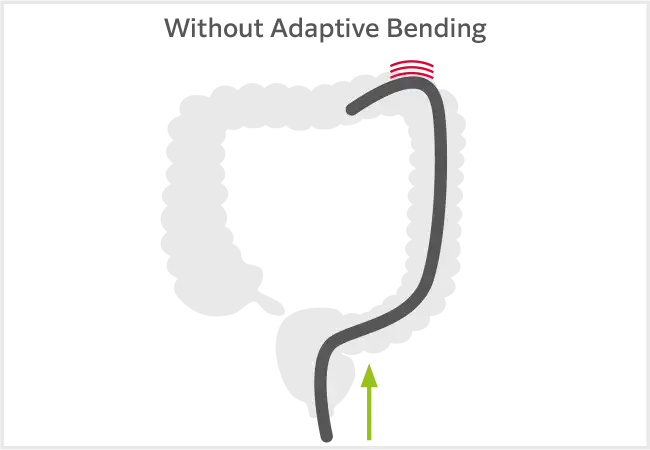 Without Adaptive Bending