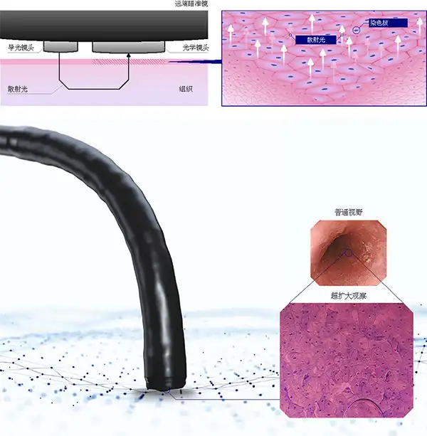 超扩大观察原理 超扩大观察原理