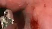 Close Focus