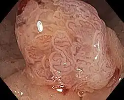 近对焦模式 Near focus mode