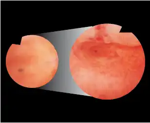 更大,更清晰的成像 Bigger, Clearer Imaging