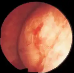 高分辨率和亮度 Exceptional Resolution and Brightness