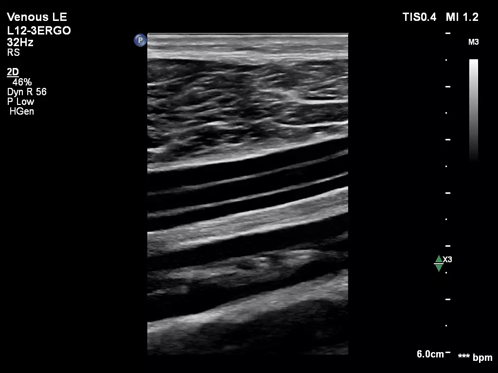 L12-3ERGO Lower Limb Veins