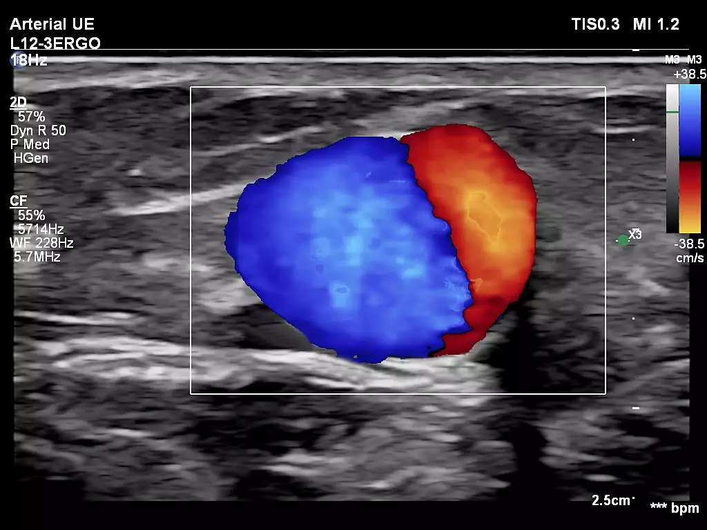 L12-3ERGO Fistula Imaging