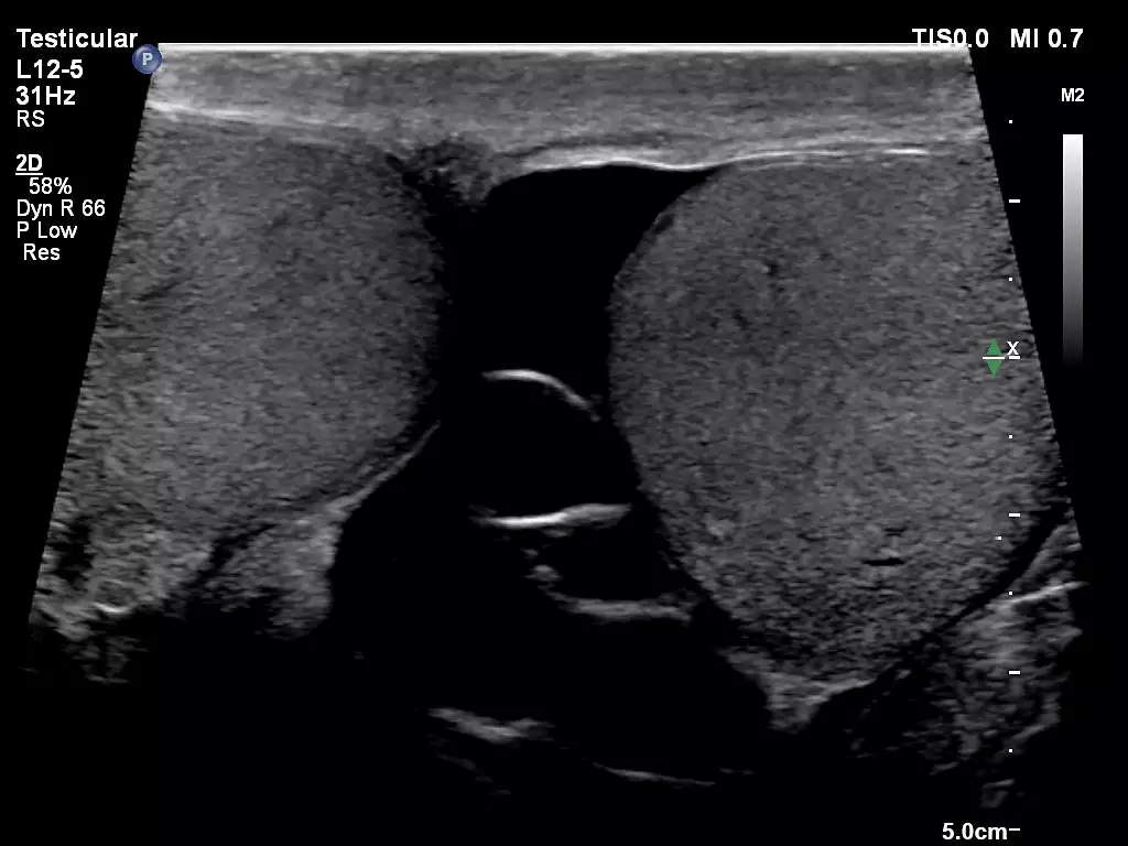 L12-5 Testicular Imaging