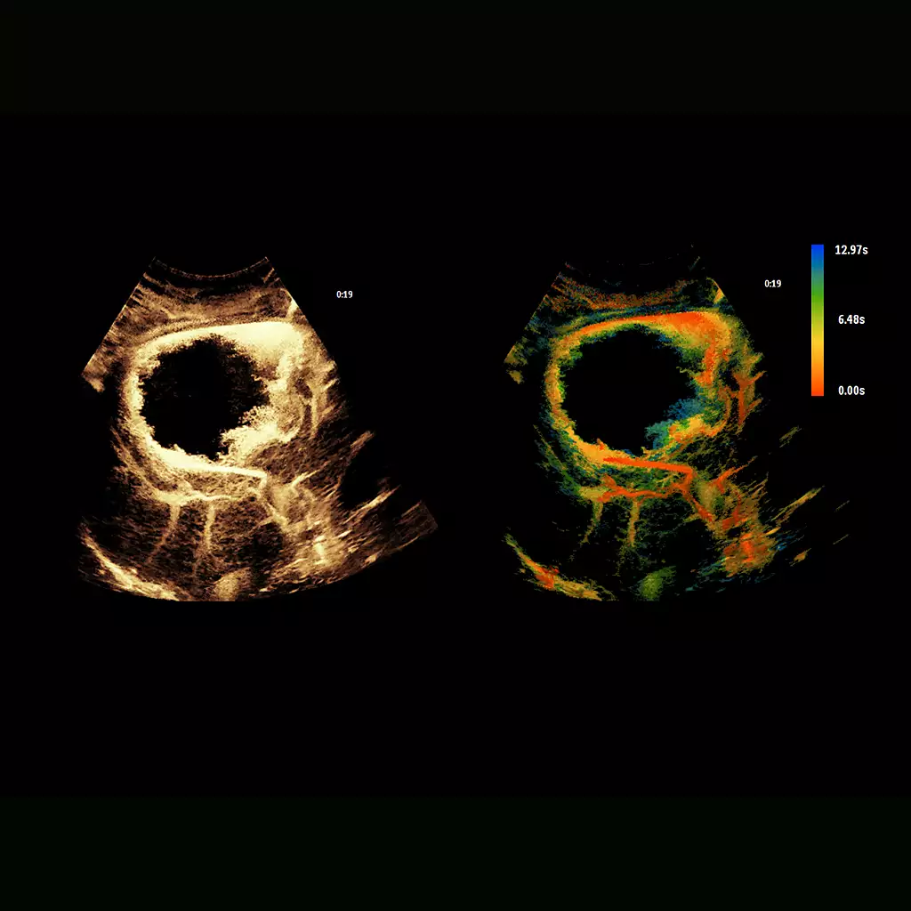 Super Resolution MVI & Time of Arrival